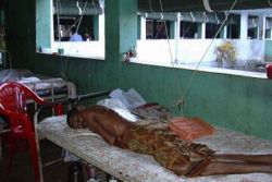 tuberkulos krankenhaus simon indienhilfe